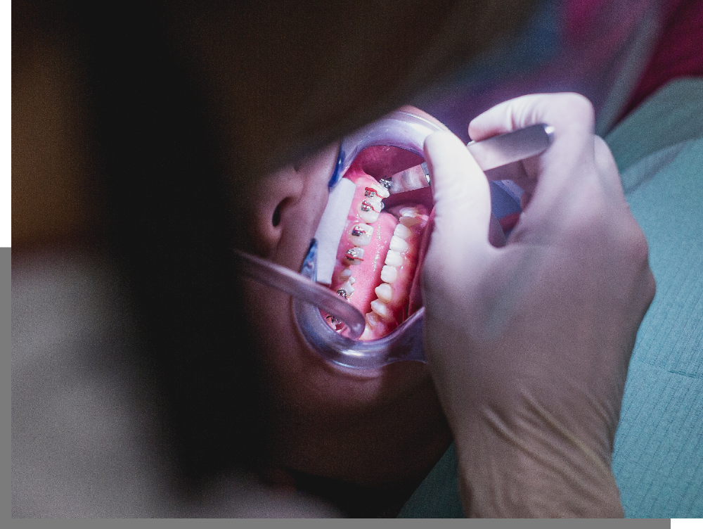 Centro Dental Macía | Dentistas en Santiago