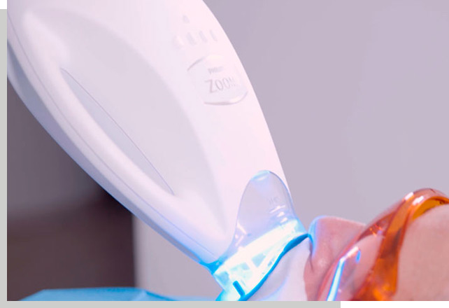 BlanqueamientoDentalQueEs-CentroDentalMacia implantes dentales en Santiago de Compostela