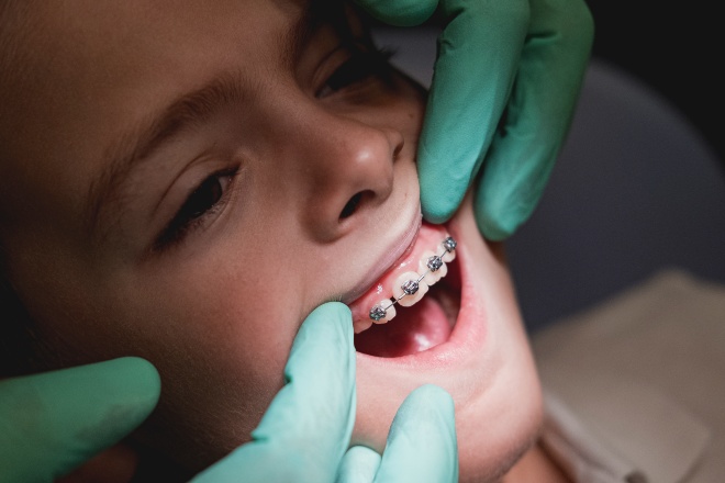 Ortodoncia infantil en Santiago